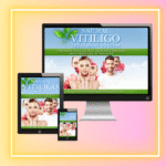 Natural Vitiligo Treatment System Reviews
