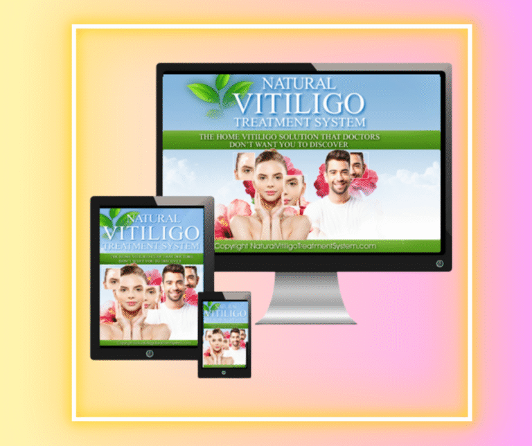 Natural Vitiligo Treatment System Reviews